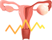 난소암 데이터 아이콘 이미지